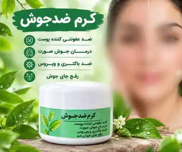 کرم ضد جوش