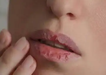 ماسک ورقه‌ای لب بیواکوا