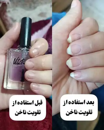 تقویت ناخن