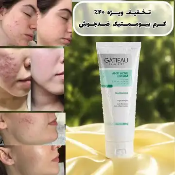 کرم ژل آنتی آکنه (ضد جوش وضد لک)گاتیو